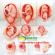 VENDA 12451 Processo de desenvolvimento para peças Fetus 10 em modelos da série Natural